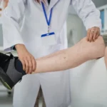 advercopys varices